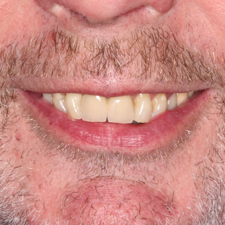 Transform Your Smile