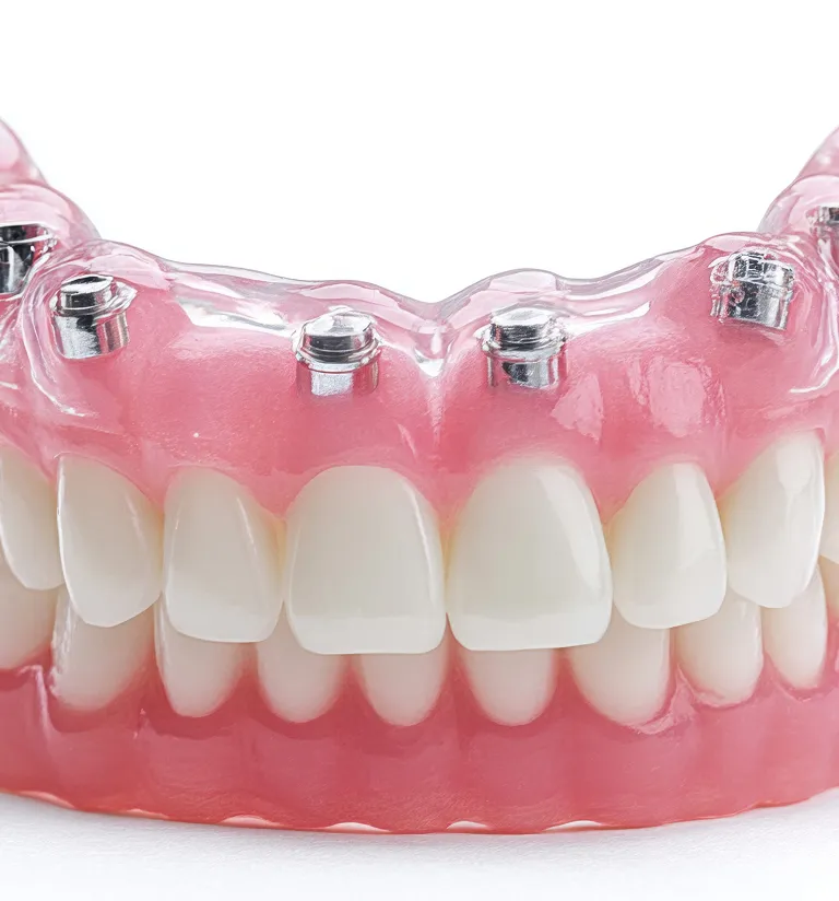 Restore More Than Your Smile