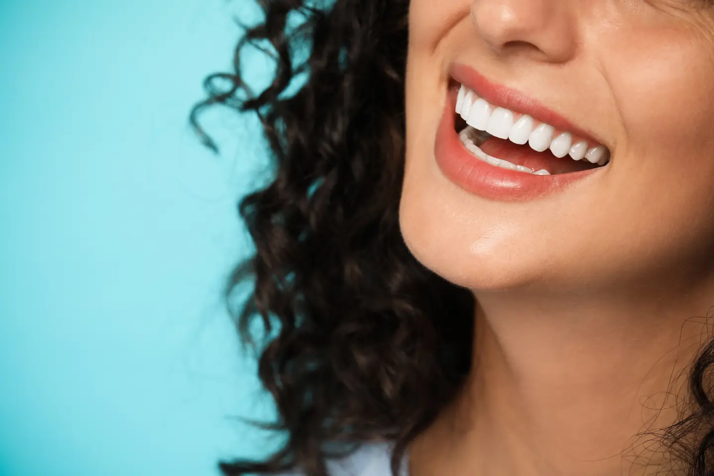 Unlock a Perfect Smile in Just One Visit with Veneers