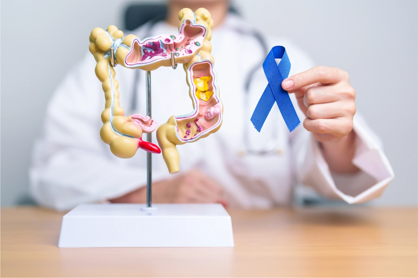 Colorectal Surgery