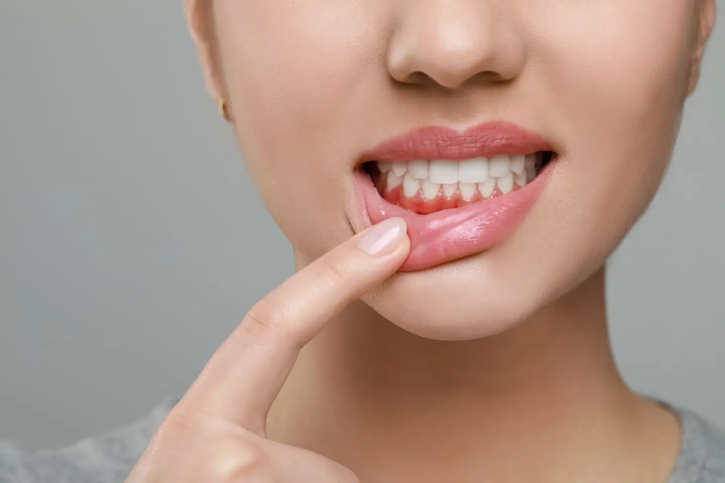 Gum Surgery 