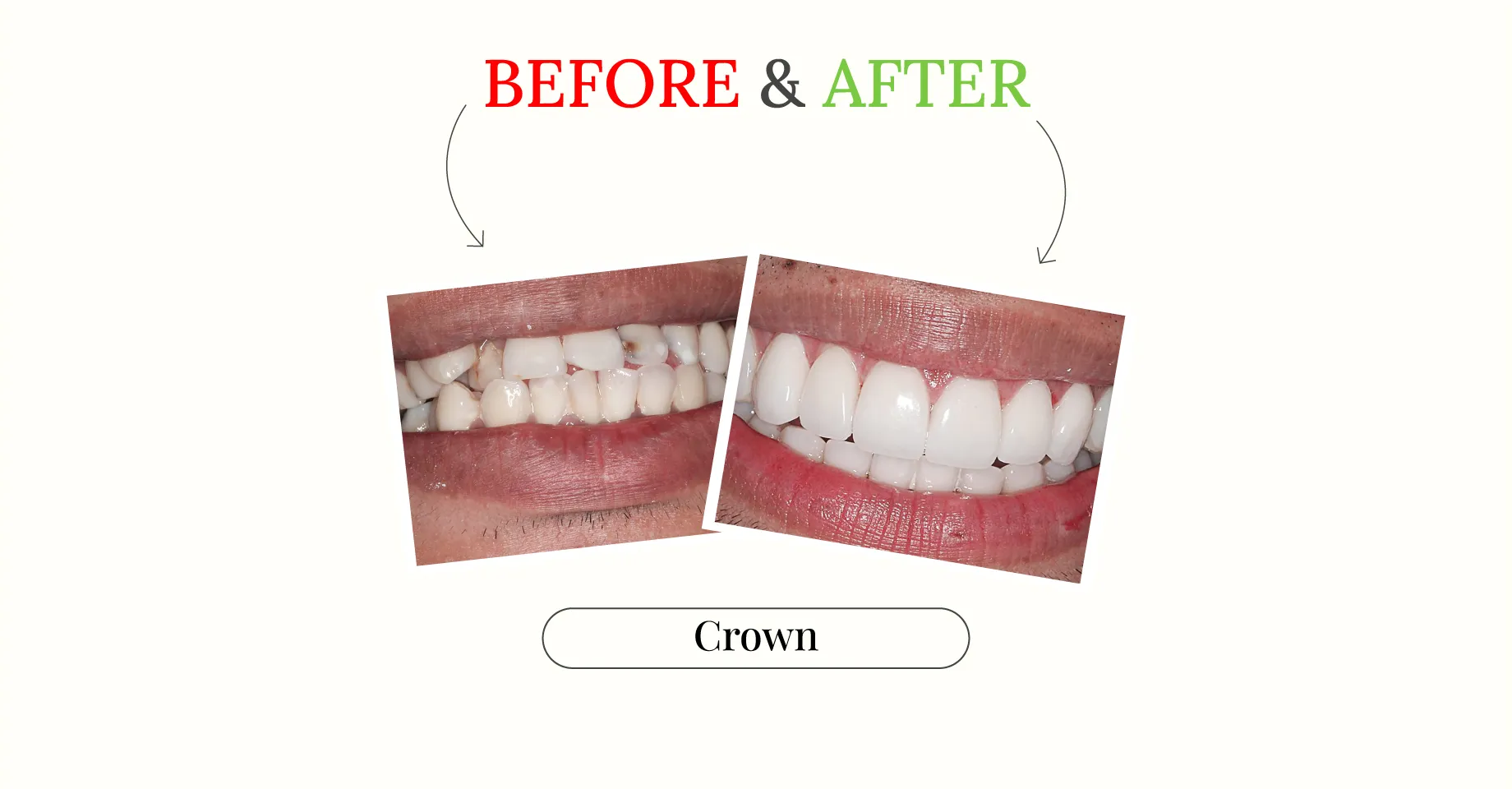 Generating Bright Smiles at Sacramento West Dental Office, CA