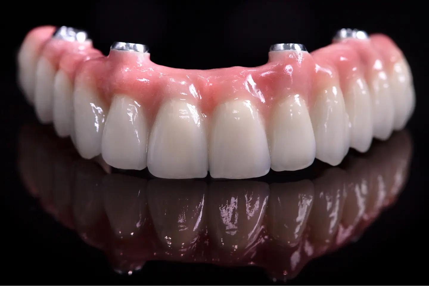 A Brief Comparison Between Implant-Supported Dentures and Traditional Dentures