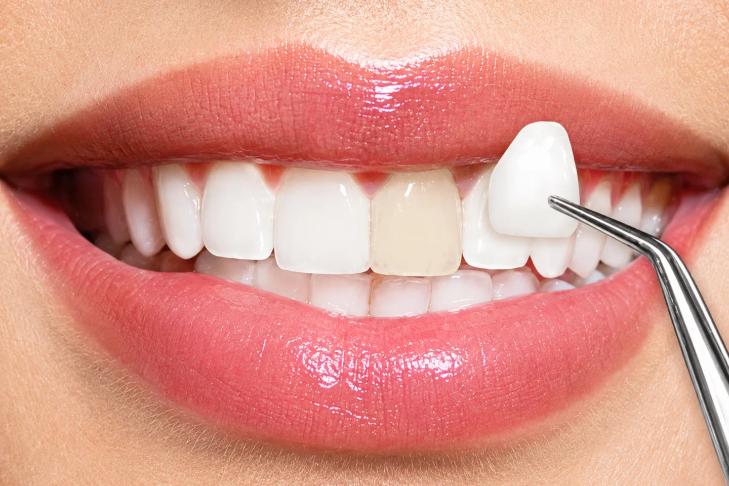 Cosmetic Dentist in Cupertino