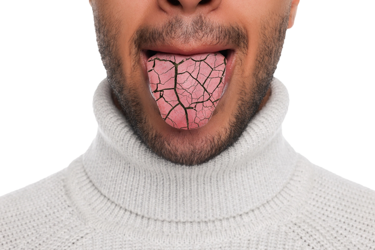 Causes of dry mouth and dehydration affecting oral health in Ripon CA