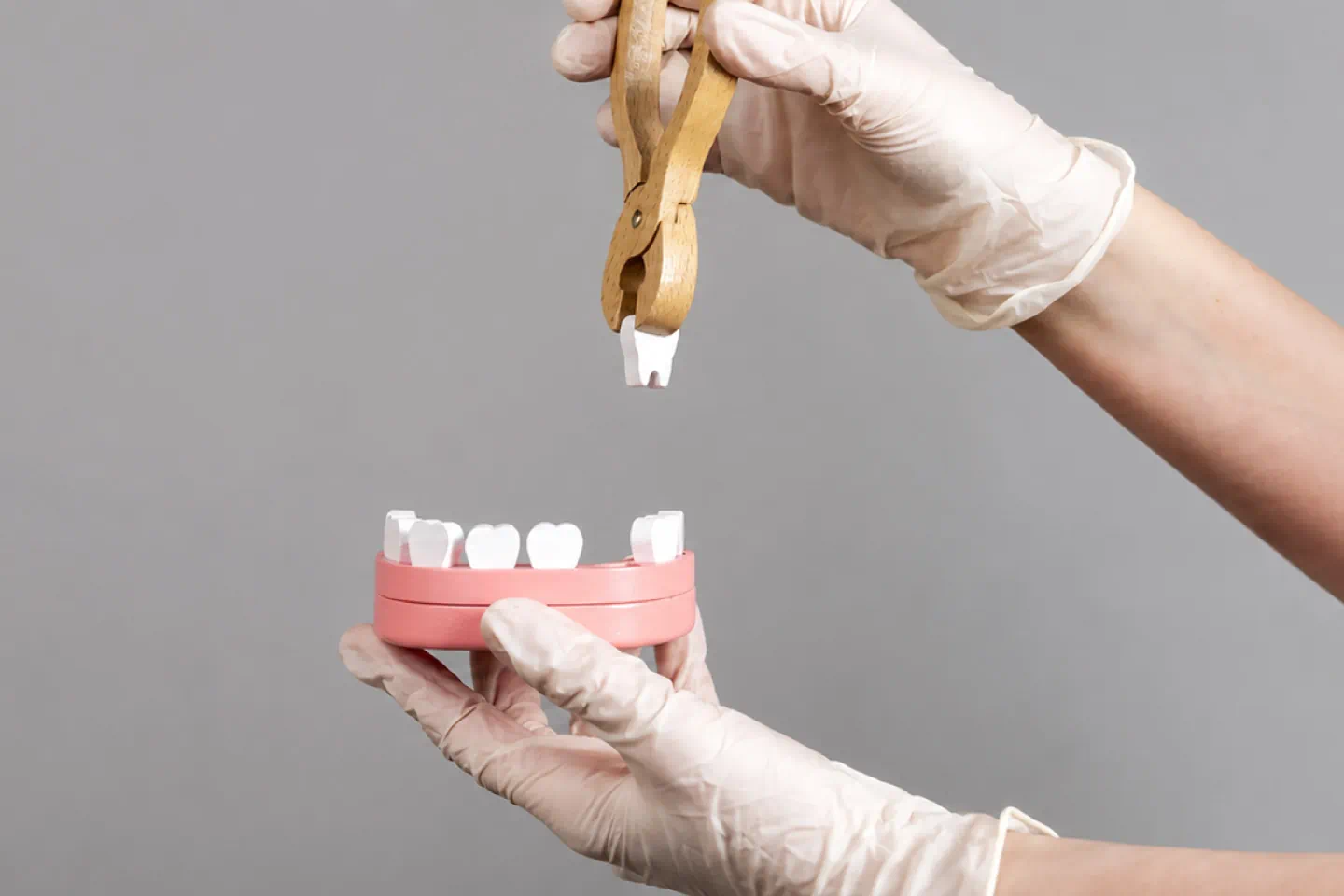 tooth extraction