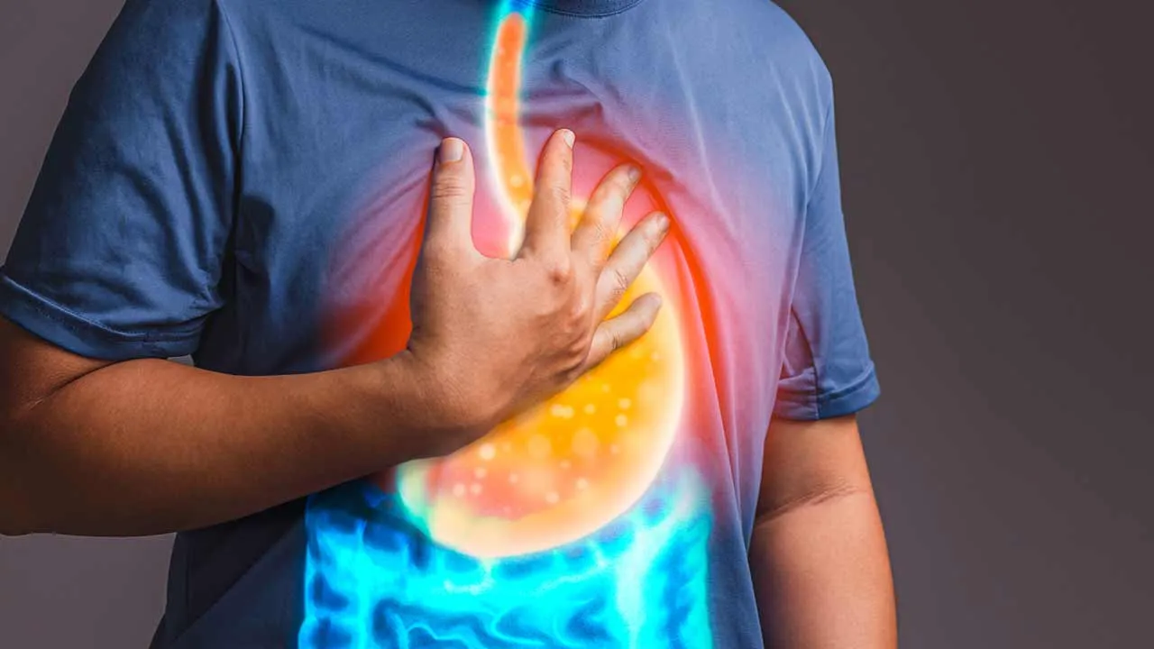 GERD Treatment: Natural Remedies & Advanced Endoscopy