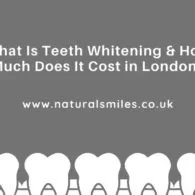 Teeth Whitening in London & How Much Does It Cost?