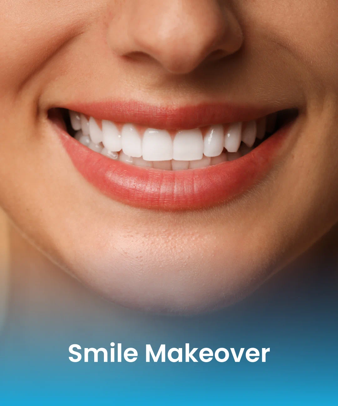 Beautiful smile after smile makeover