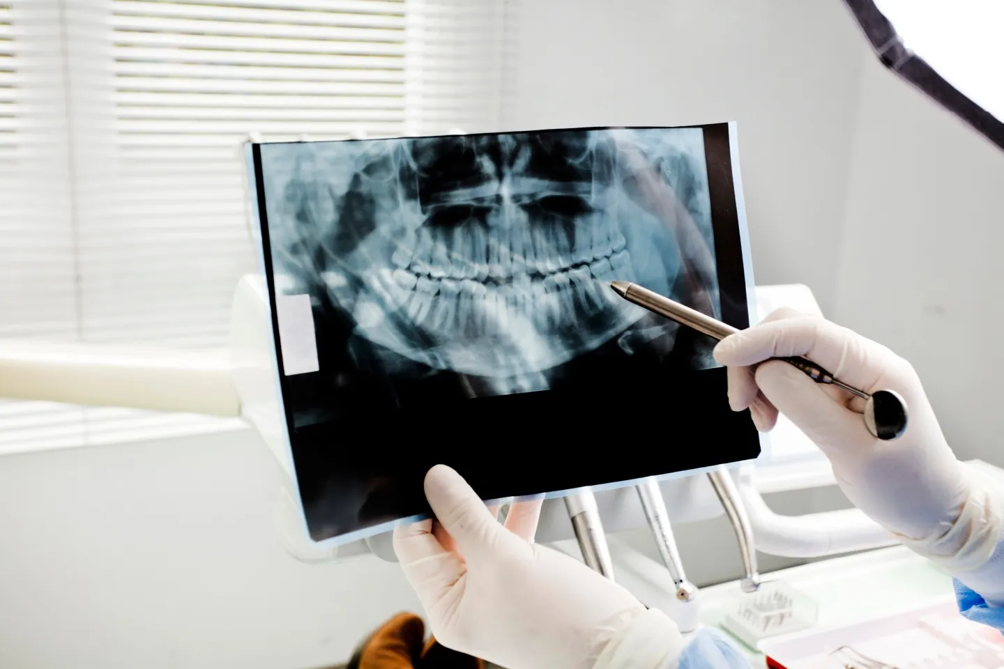 Full Mouth X-ray