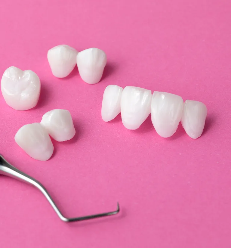 How Do All-On-4 Dentures Work?