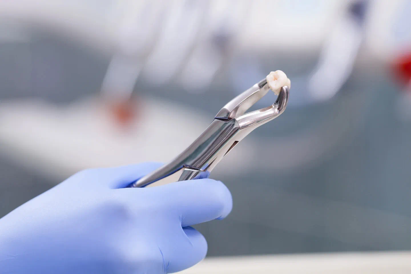 Tooth Extractions in Joliet, IL
