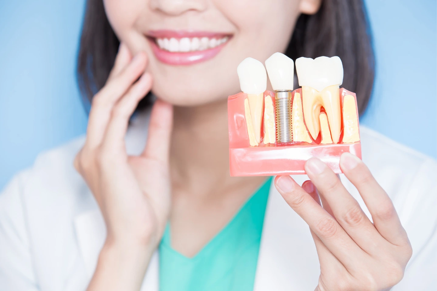 Full Mouth Dental Implants in One Day: Is It Possible?