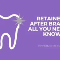 Retainers After Braces – All You Need To Know