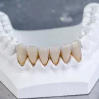 Zirconia Veneers – Benefits, Procedure, Costs & more