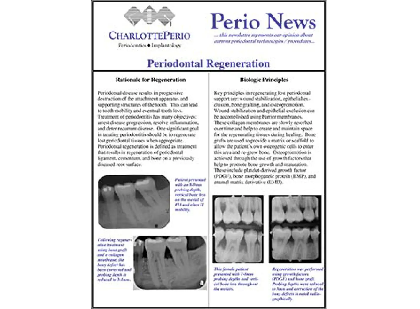 Periodontal Regeneration