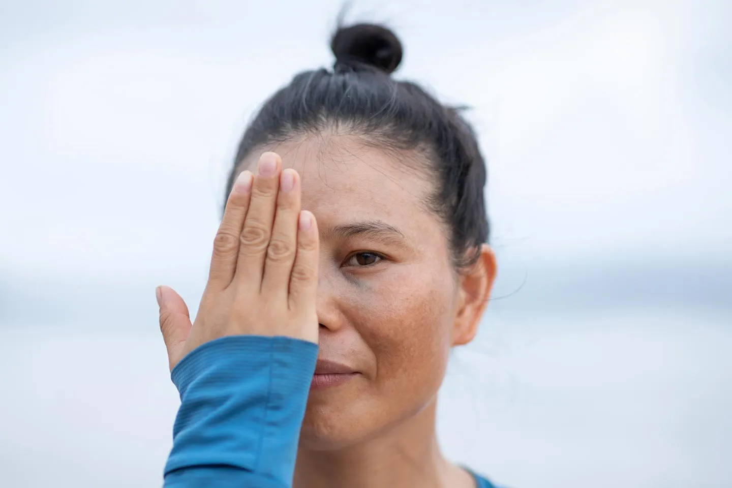 Sports-Related Eye Injuries