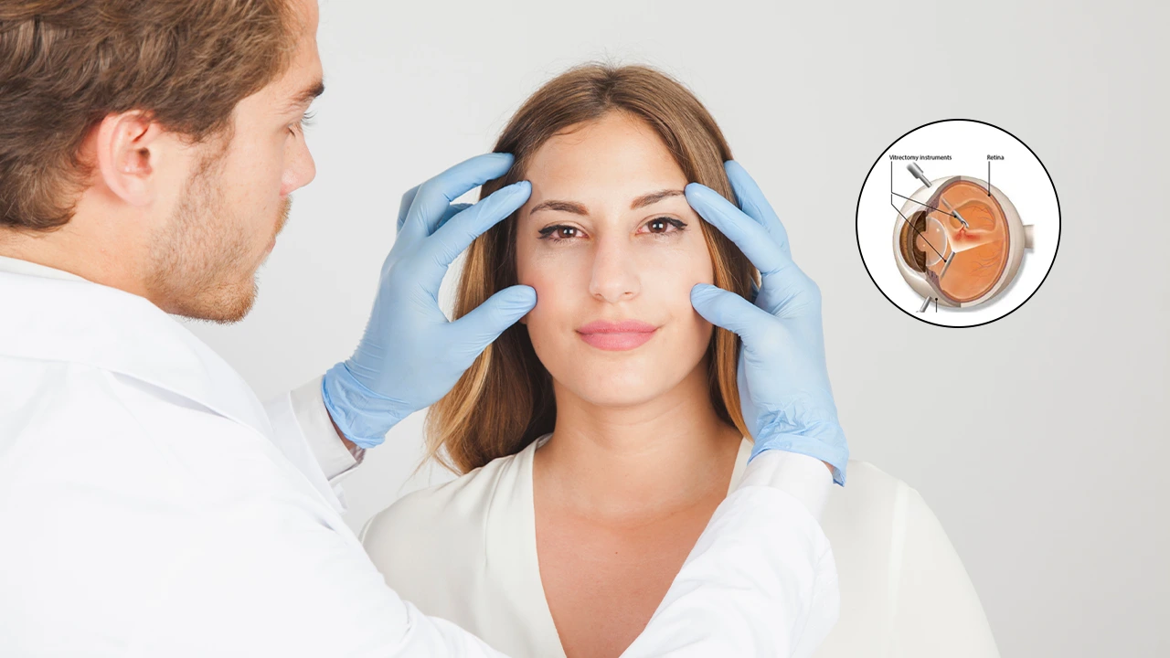 Eye with surgical instruments performing vitrectomy.