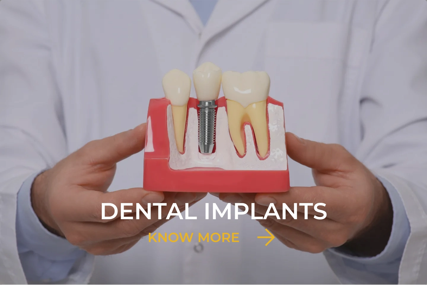 Dental Implants