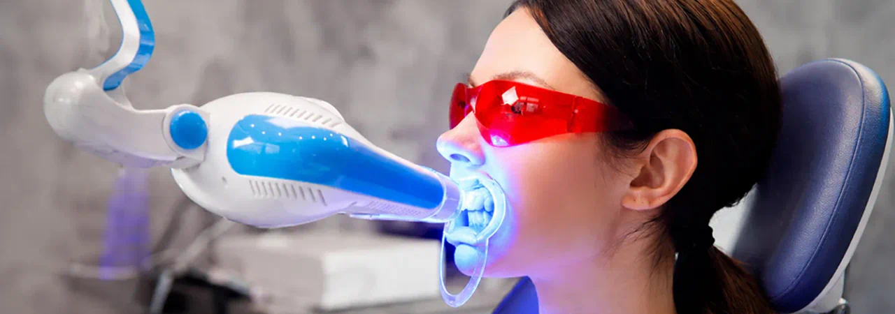 Teeth Whitening