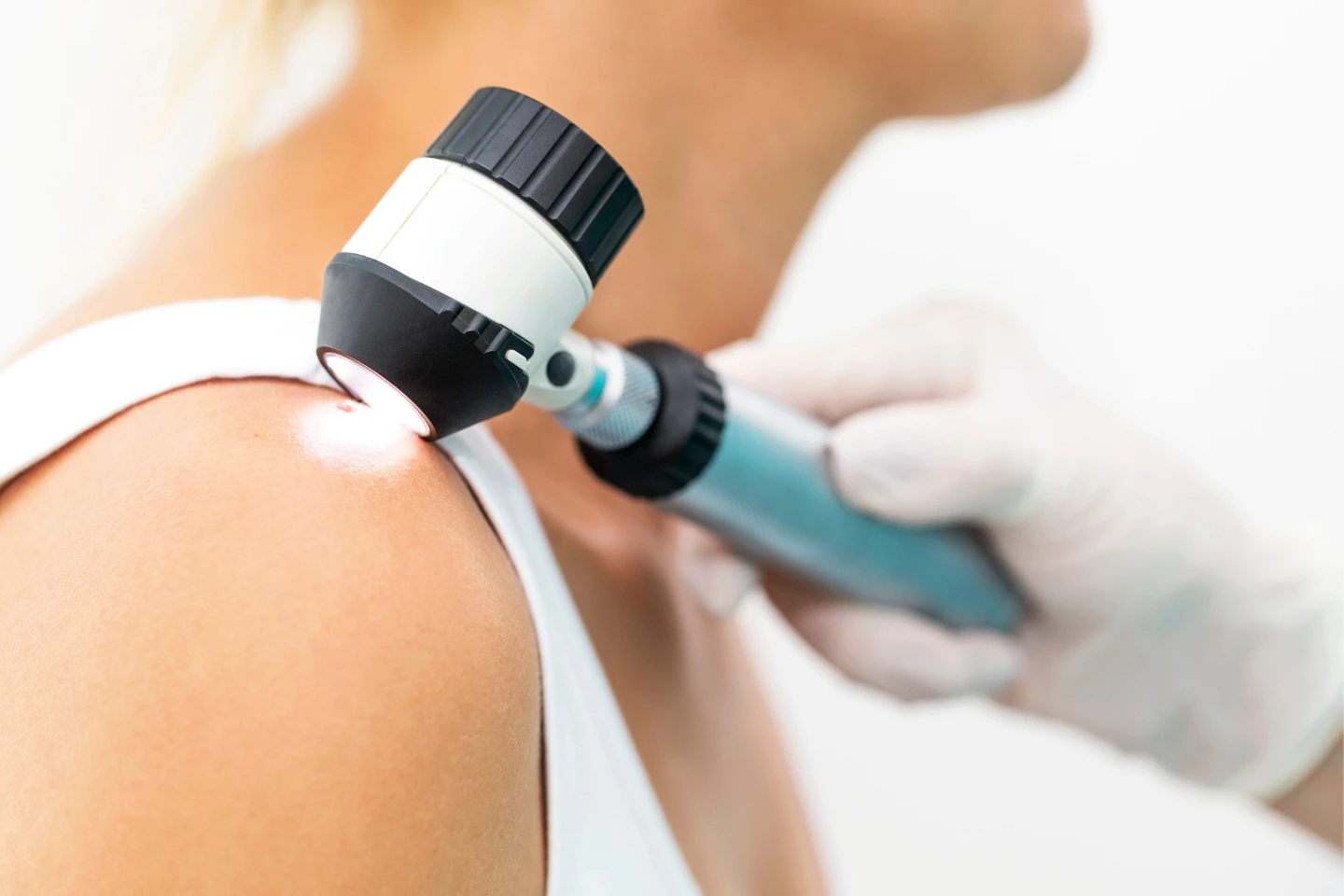 Understanding Skin Cancer Treatment Options in Beachwood, OH