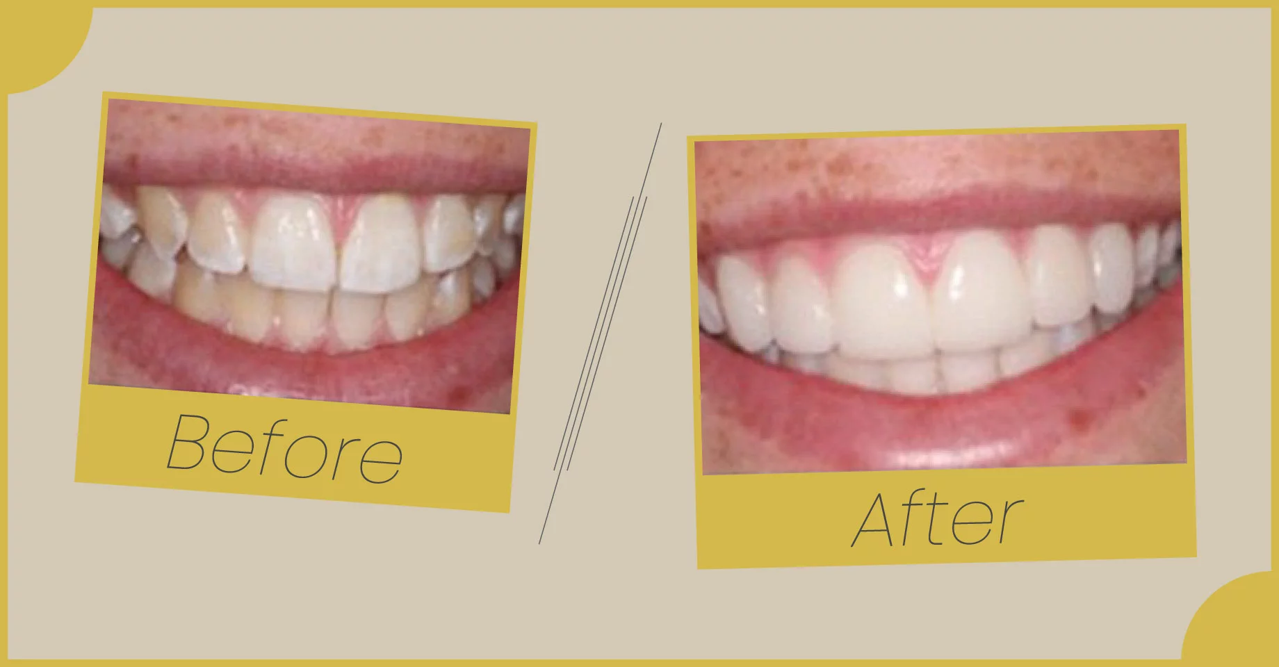 Transformation Results of Dental Care at Smile Saver Dental