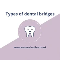 Types of dental bridges
