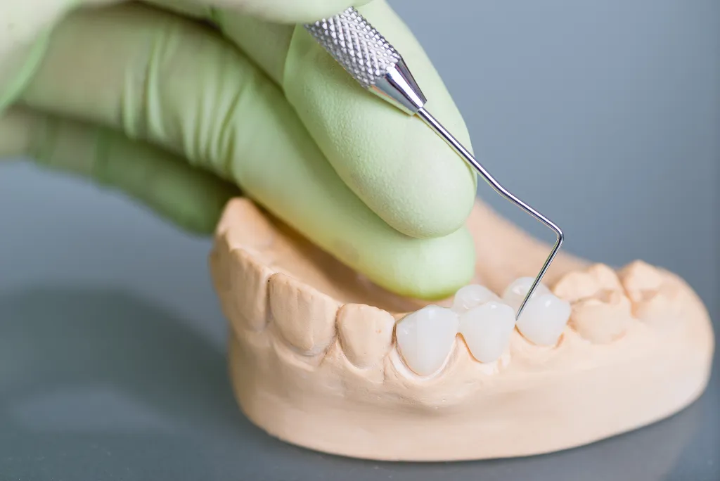 Dental Crown Procedure Guide – Types, Care and Benefits