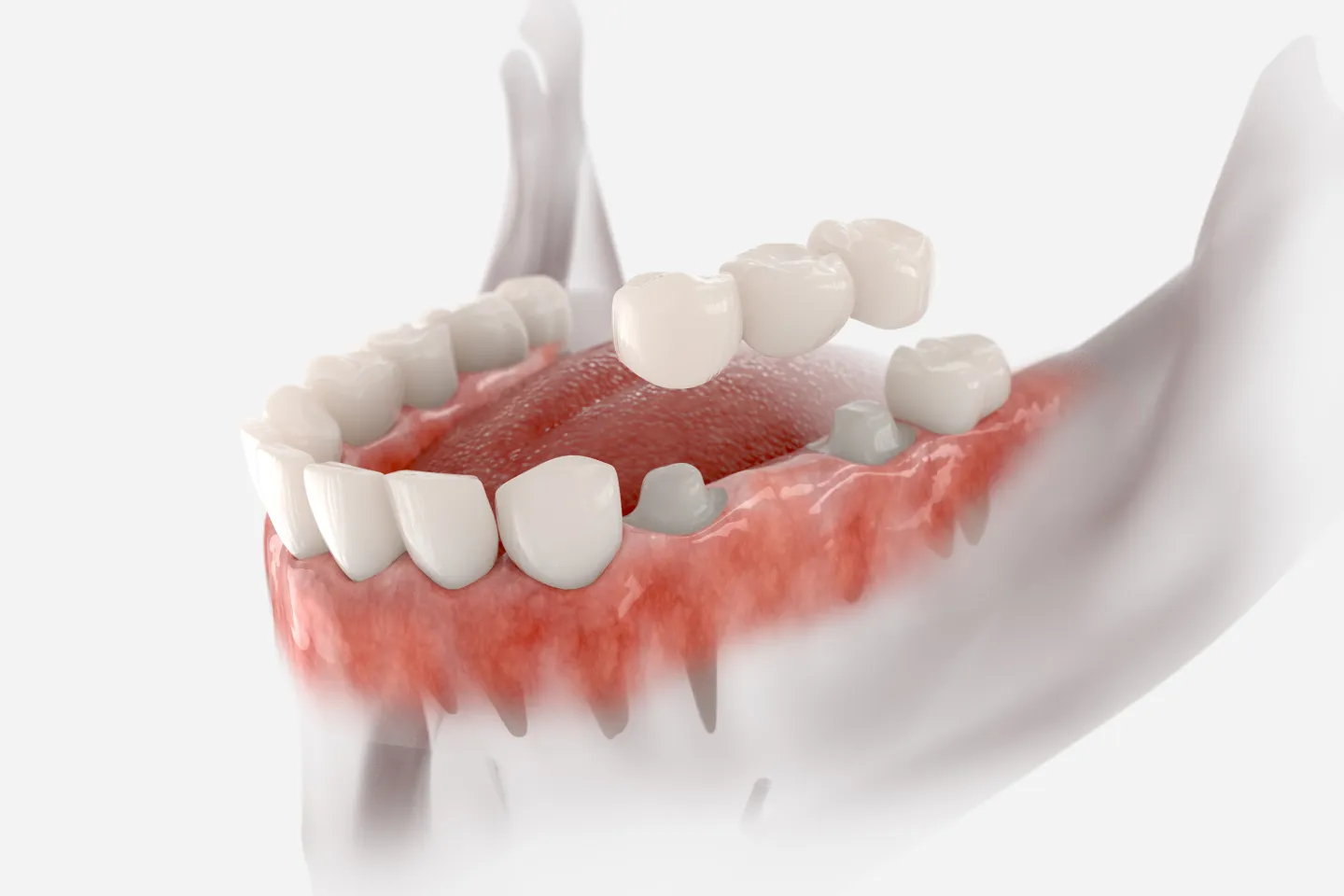 dental implants specialists in Glendale Heights, IL