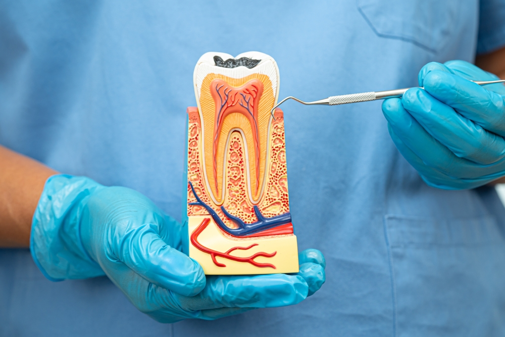 Dental Implants