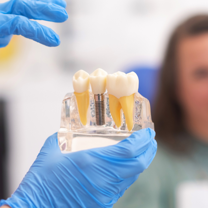Implant Dentistry in Rehoboth, MA