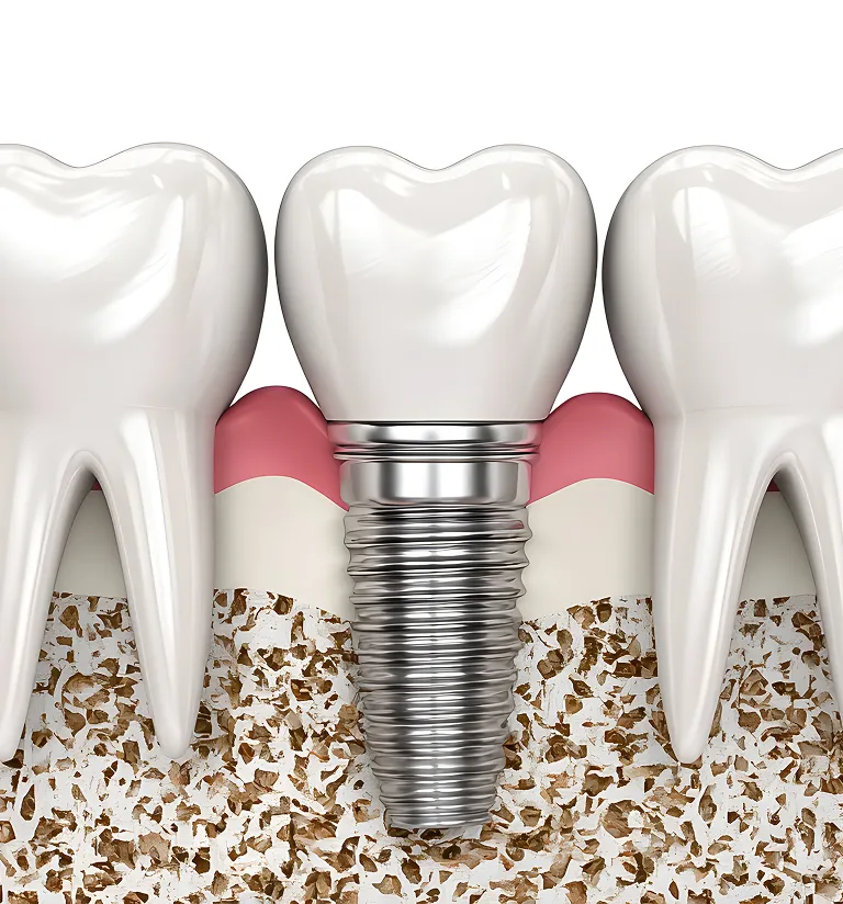 How to Choose the Right Cosmetic Dentist for Your Smile Goals