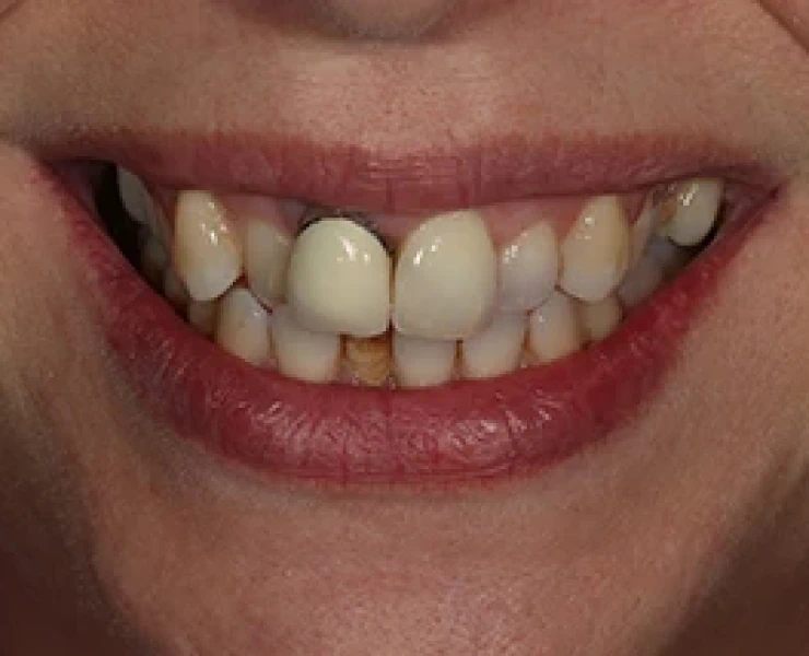 Dental Care 3