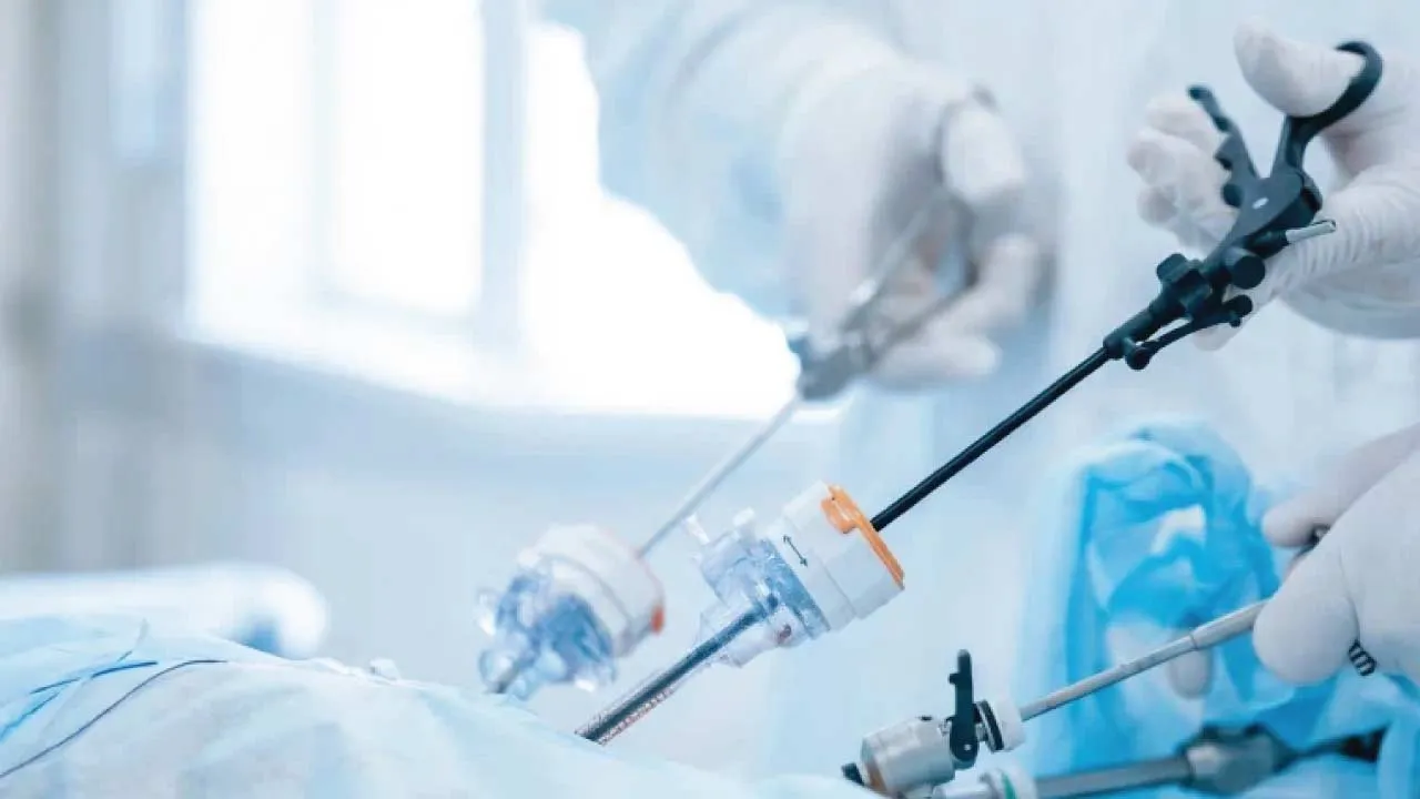 laparoscopic gynecology surgery medical diagram