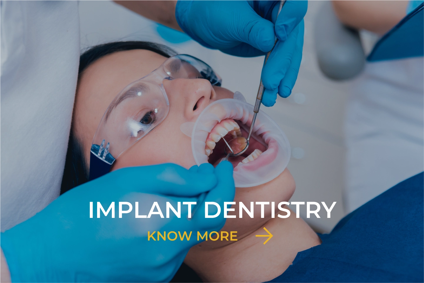 Image for implant dentistry