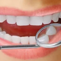 Turkey Teeth – All You Need To Know About It