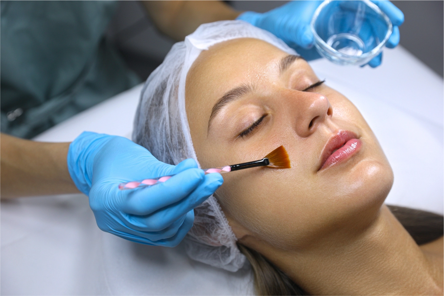 Chemical Peels 101: Benefits, Risks, and Results