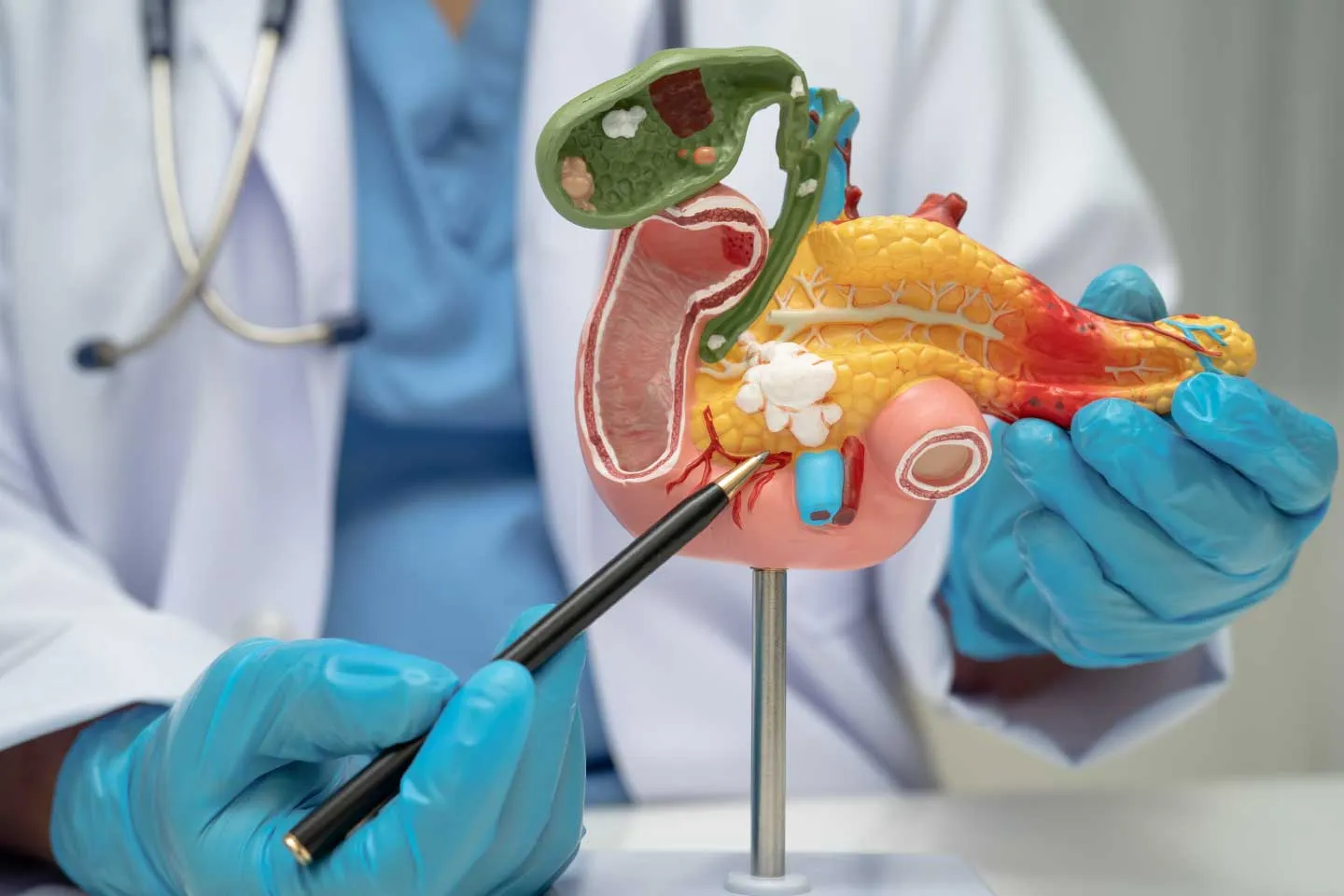 Stomach and Duodenum