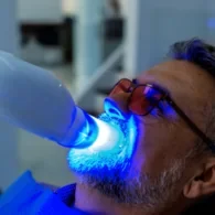 Can Yellow Teeth Become White Through Teeth Whitening?