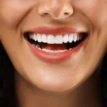 What Can I Expect From a Smile Makeover Consultation in Corby?