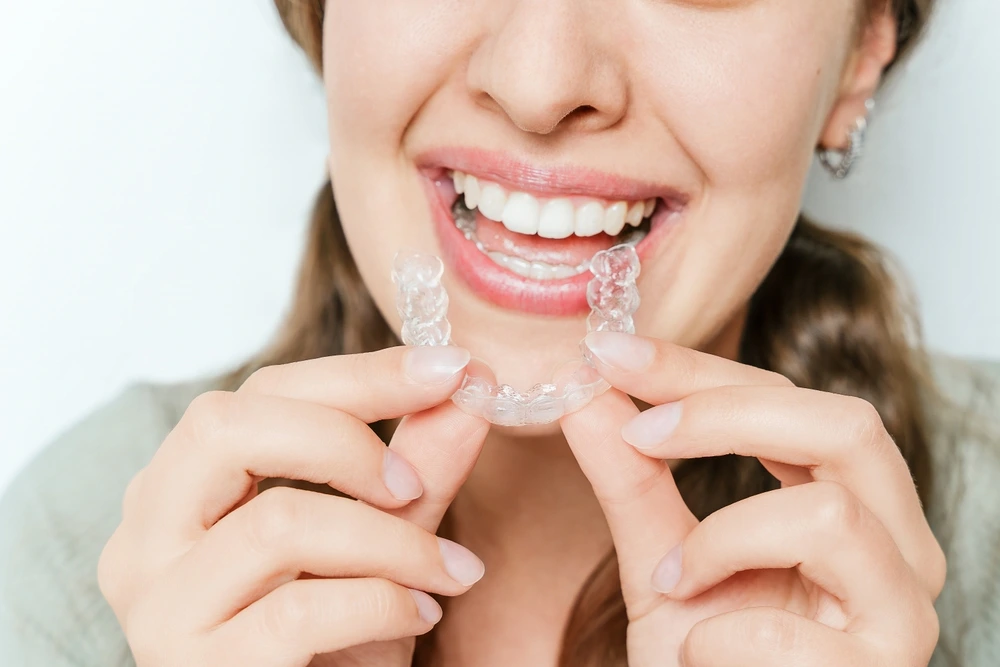 Clear Aligners