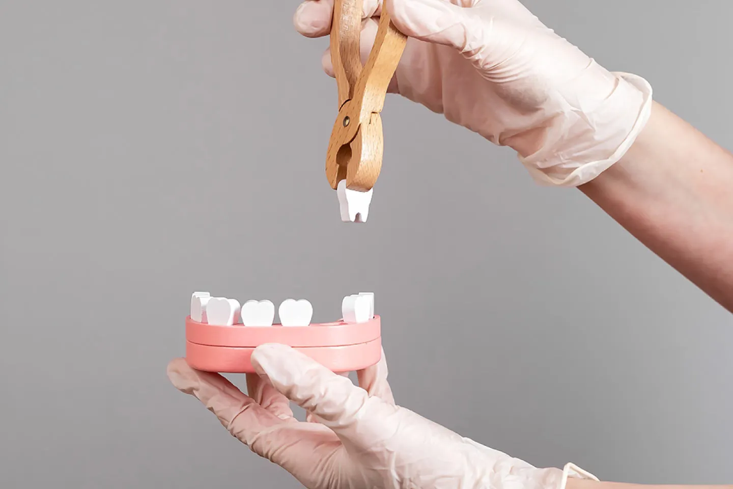 Extraction & Implants procedures at Springfield Dental