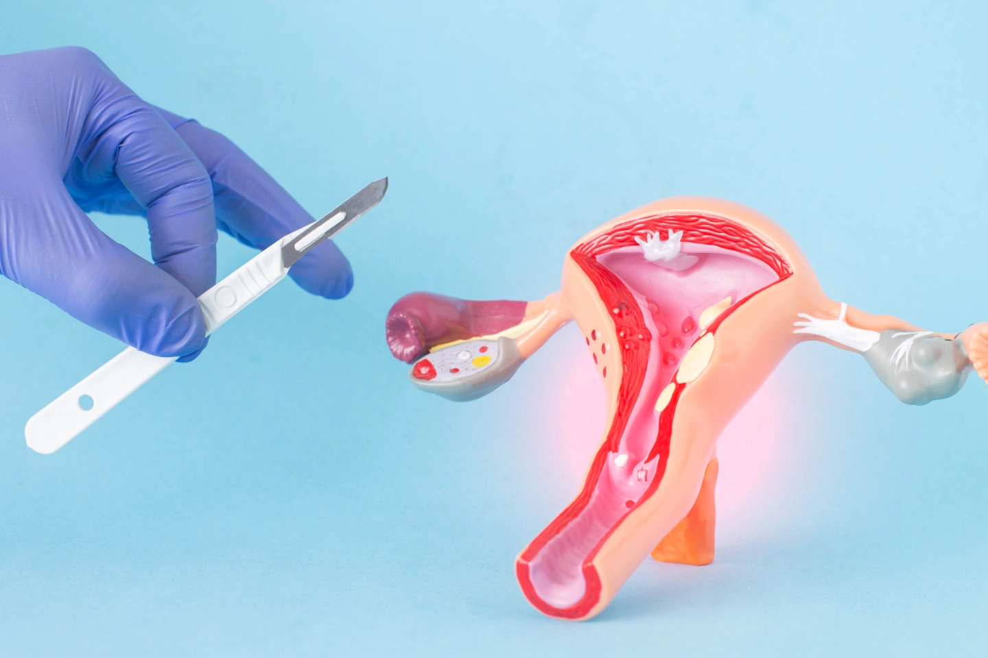 Robotic And Laparoscopic Surgery