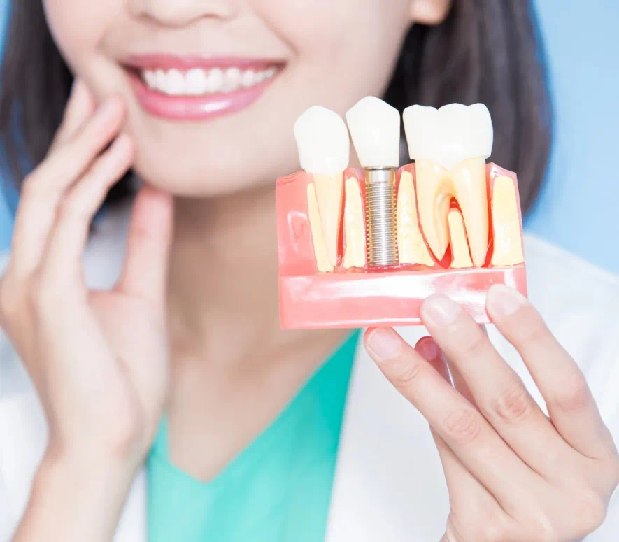 Dental Implants   