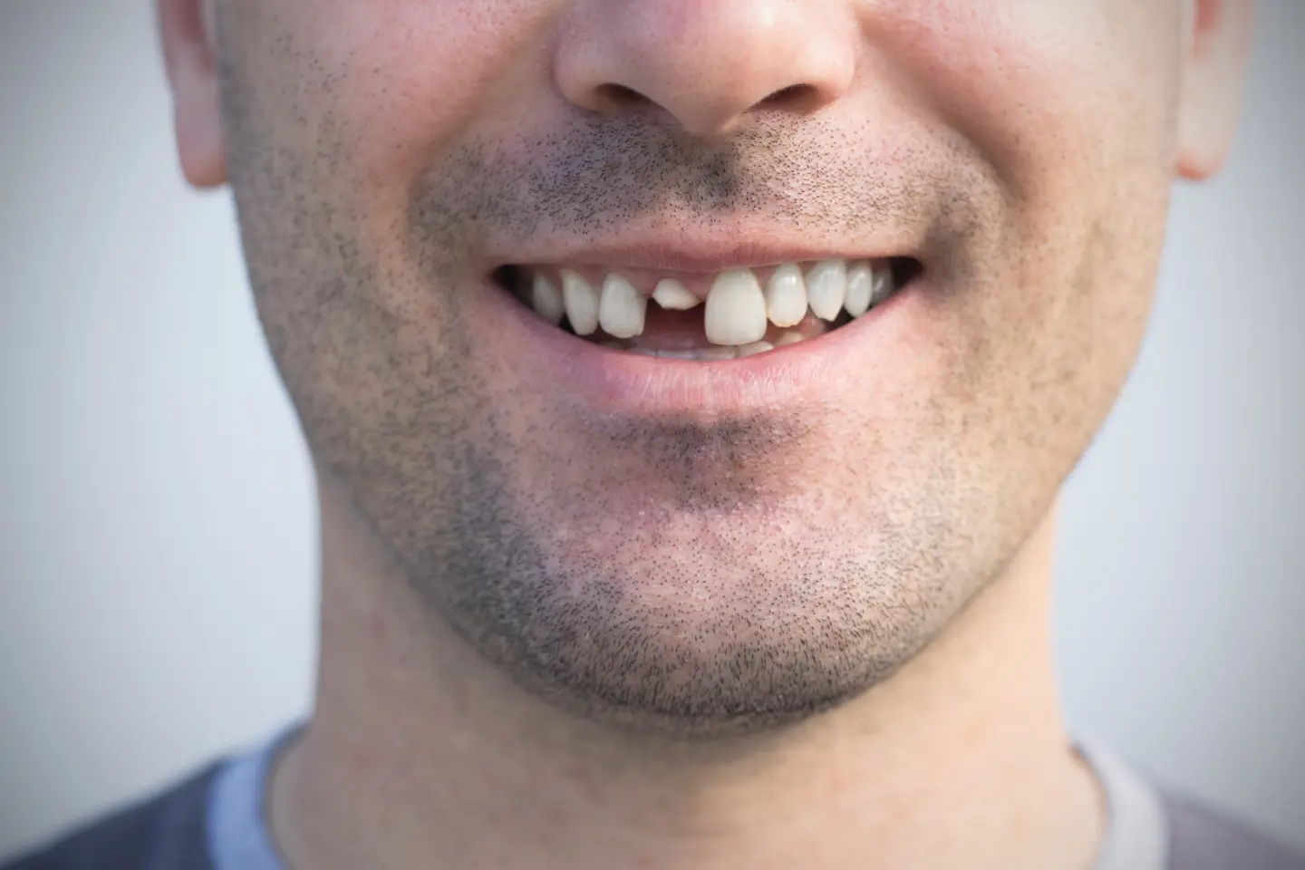  Dental Emergencies