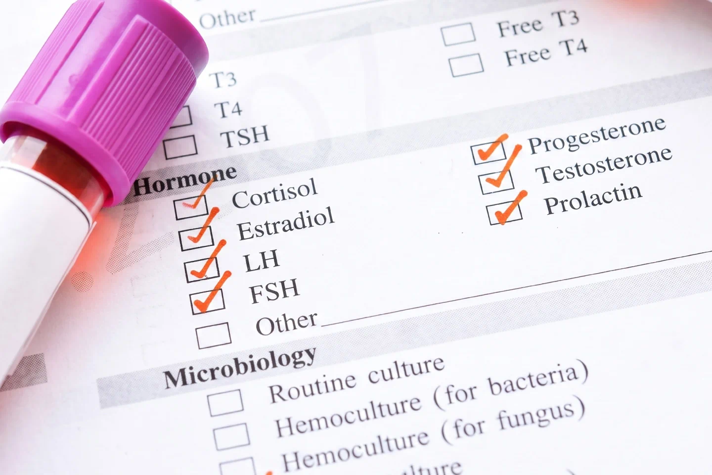 Blood & Hormone Tests