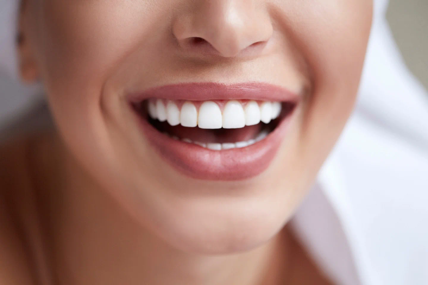 The Benefits of Professional Teeth Whitening in Chicopee, MA