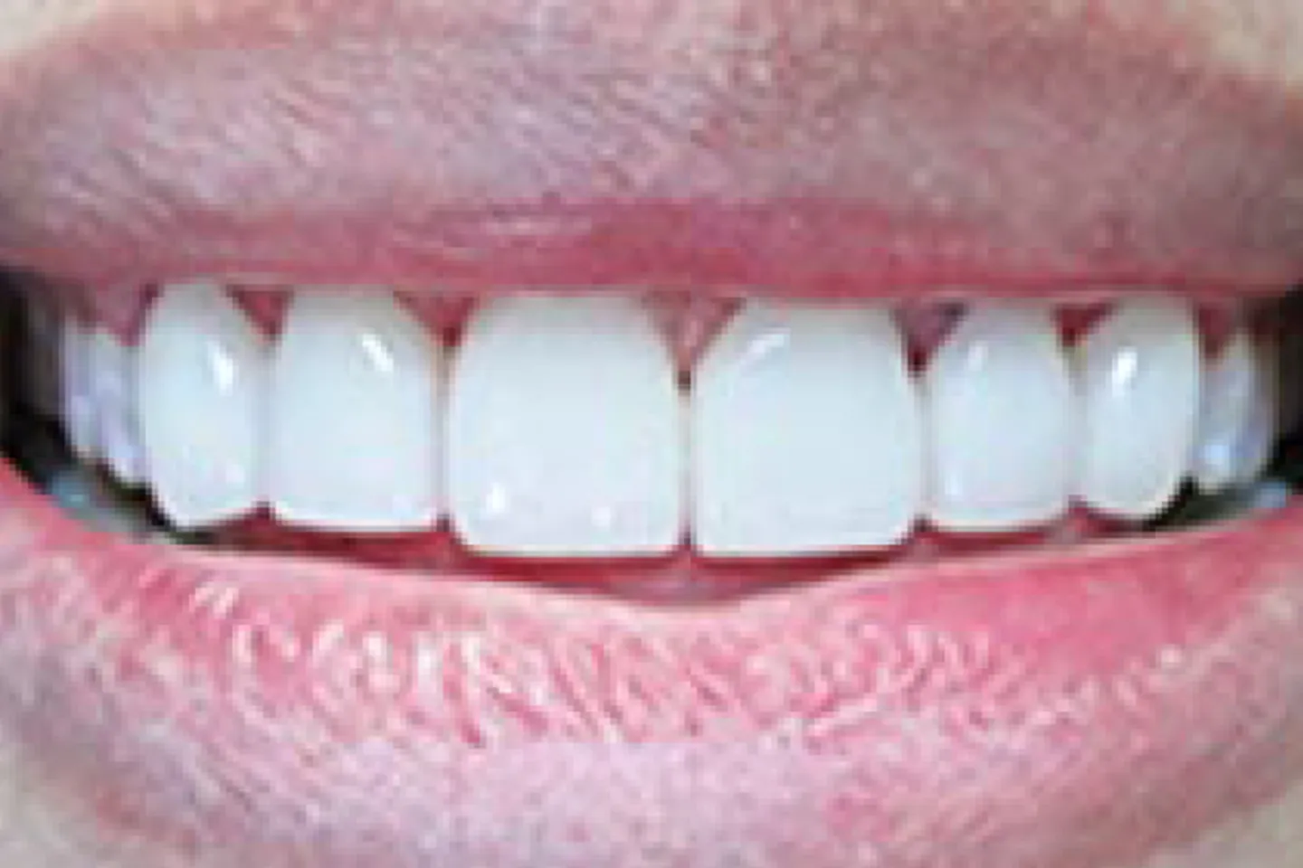 main-image