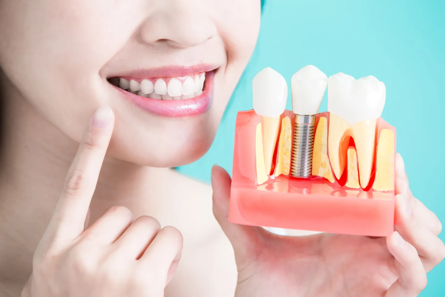  Dental implants consultation with Dr. Isaac Menasha at IM Dentistry, the best dentist in New Jersey