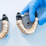 Different Ways of Teeth Replacement
